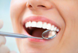 The Advantages of Dental Implants