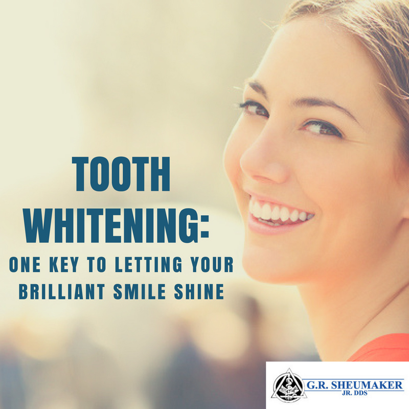 Tooth Whitening: One Key to Letting Your Brilliant Smile Shine