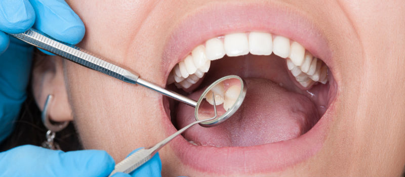 Dentist checkups