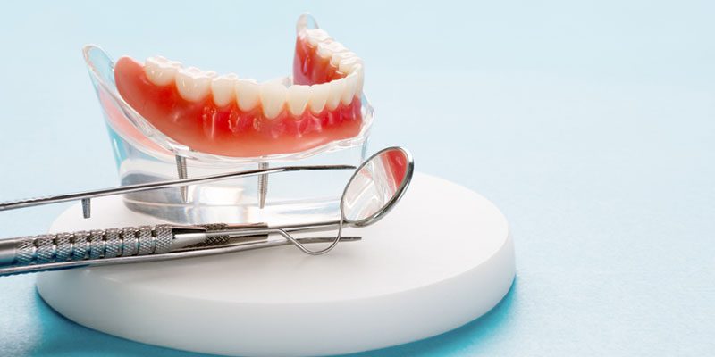 Dealing with Dentures: 4 Common Reasons for Denture Repair